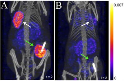 Preclinical Advances in Theranostics for the Different Molecular Subtypes of Breast Cancer